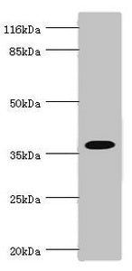 Western blot All lanes: FBP1 antibody at 3.06ug/ml Lane 1: Mouse liver tissue Lane 2: Mouse kidney tissue Secondary Goat polyclonal to rabbit IgG at 1/10000 dilution Predicted band size: 37 kDa Observed band size: 37 kDa