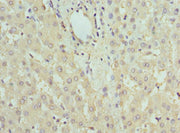 Immunohistochemistry of paraffin-embedded human liver tissue using CSB-PA008459ESR2HU at dilution of 1:100