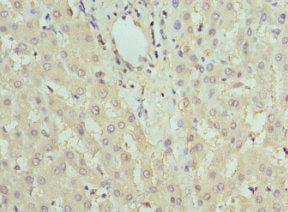Immunohistochemistry of paraffin-embedded human liver tissue using CSB-PA008459ESR2HU at dilution of 1:100