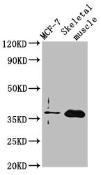 Western Blot Positive WB detected in: MCF-7 whole cell lysate, Rat skeletal muscle tissue All lanes: FBP2 antibody at 3.5ug/ml Secondary Goat polyclonal to rabbit IgG at 1/50000 dilution Predicted band size: 37 kDa Observed band size: 37 kDa