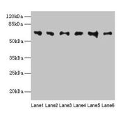 Western blot All lanes: FBXO24 antibody at 1µg/ml Lane 1: Mouse gonadal tissue Lane 2: Mouse kidney tissue Lane 3: A549 whole cell lysate Lane 4: 293T whole cell lysate Lane 5: Jurkat whole cell lysate Lane 6: MCF-7 whole cell lysate Secondary Goa...