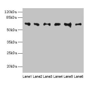 Western blot All lanes: FBXO24 antibody at 1µg/ml Lane 1: Mouse gonadal tissue Lane 2: Mouse kidney tissue Lane 3: A549 whole cell lysate Lane 4: 293T whole cell lysate Lane 5: Jurkat whole cell lysate Lane 6: MCF-7 whole cell lysate Secondary Goa...