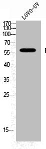 Western Blot analysis of LOVO+UV cells using Phospho-Fyn (Y530) Polyclonal Antibody