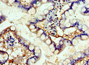 Immunohistochemistry of paraffin-embedded human small intestine tissue using CSB-PA008525ESR1HU at dilution of 1:100