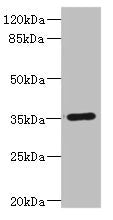 Western blot All lanes: FCGR2C antibody IgG at 1.67ug/ml + Human Burkitt lymphoma cells Secondary Goat polyclonal to rabbit IgG at 1/10000 dilution Predicted band size: 36, 31, 30, 26 kDa Observed band size: 36 kDa