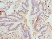 Immunohistochemistry of paraffin-embedded human lung tissue using CSB-PA008550ESR1HU at dilution of 1:100