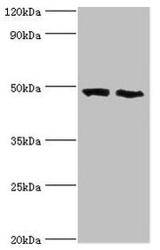 Western blot All lanes: FDFT1 antibody at 2µg/ml Lane 1: 293T whole cell lysate Lane 2: Mouse liver tissue Secondary Goat polyclonal to rabbit IgG at 1/10000 dilution Predicted band size: 49, 41, 39, 36, 44 kDa Observed band size: 49 kDa