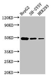 Western Blot Positive WB detected in: HepG2 whole cell lysate, SH-SY5Y whole cell lysate, HEK293 whole cell lysate All lanes: FDFT1 antibody at 3µg/ml Secondary Goat polyclonal to rabbit IgG at 1/50000 dilution Predicted band size: 49, 41, 39, 36,...