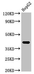 Western Blot Positive WB detected in: HepG2 whole cell lysate All lanes: FDPS antibody at 3µg/ml Secondary Goat polyclonal to rabbit IgG at 1/50000 dilution Predicted band size: 49, 41 kDa Observed band size: 41 kDa