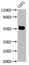 Western Blot Positive WB detected in: U251 whole cell lysate All lanes: FEZF1 antibody at 6µg/ml Secondary Goat polyclonal to rabbit IgG at 1/50000 dilution Predicted band size: 53, 47, 52 kDa Observed band size: 53 kDa