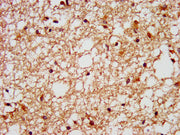 IHC image of CSB-PA008604LA01HU diluted at 1:400 and staining in paraffin-embedded human brain tissue performed on a Leica BondTM system. After dewaxing and hydration, antigen retrieval was mediated by high pressure in a citrate buffer (pH 6.0). S...