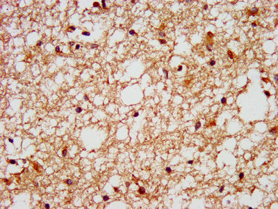 IHC image of CSB-PA008604LA01HU diluted at 1:400 and staining in paraffin-embedded human brain tissue performed on a Leica BondTM system. After dewaxing and hydration, antigen retrieval was mediated by high pressure in a citrate buffer (pH 6.0). S...