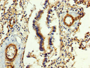 IHC image of CSB-PA008608LA01HU diluted at 1:400 and staining in paraffin-embedded human lung tissue performed on a Leica BondTM system. After dewaxing and hydration, antigen retrieval was mediated by high pressure in a citrate buffer (pH 6.0). Se...