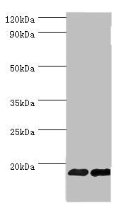Western blot All lanes: Fibroblast growth factor 1 antibody at 6ug/ml Lane 1: Mouse kidney tissue Lane 2: Mouse heart tissue Secondary Goat polyclonal to rabbit IgG at 1/10000 dilution Predicted band size: 18, 7 kDa Observed band size: 18 kDa