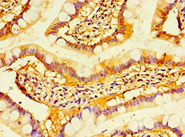 Immunohistochemistry of paraffin-embedded human small intestine tissue using CSB-PA008619ESR2HU at dilution of 1:100