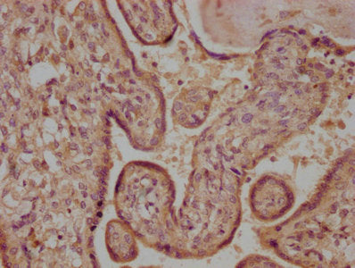 IHC image of CSB-PA008621LA01HU diluted at 1:100 and staining in paraffin-embedded human placenta tissue performed on a Leica BondTM system. After dewaxing and hydration, antigen retrieval was mediated by high pressure in a citrate buffer (pH 6.0)...