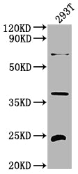 Western Blot Positive WB detected in: 293T whole cell lysate All lanes: FGF19 antibody at 1:2000 Secondary Goat polyclonal to rabbit IgG at 1/50000 dilution Predicted band size: 25 kDa Observed band size: 25 kDa