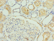 Immunohistochemistry of paraffin-embedded human kidney tissue using CSB-PA008624ESR1HU at dilution of 1:100