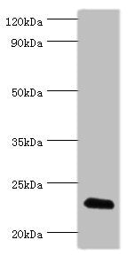 Western blot All lanes: FGF6 antibody at 10ug/ml + HepG2 whole cell lysate Secondary Goat polyclonal to rabbit IgG at 1/10000 dilution Predicted band size: 23 kDa Observed band size: 23 kDa