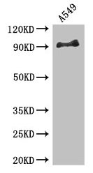 Western Blot Positive WB detected in: A549 whole cell lysate All lanes: FGFR1 antibody at 3.4µg/ml Secondary Goat polyclonal to rabbit IgG at 1/50000 dilution Predicted band size: 92, 74, 7, 83, 64, 82, 75, 56, 17, 34, 91, 96 kDa Observed band siz...