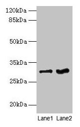 Western blot All lanes: FGFR1OP2 antibody at 6µg/ml Lane 1: Mouse gonadal tissue Lane 2: Human placenta tissue Secondary Goat polyclonal to rabbit IgG at 1/10000 dilution Predicted band size: 30, 25, 21 kDa Observed band size: 30 kDa