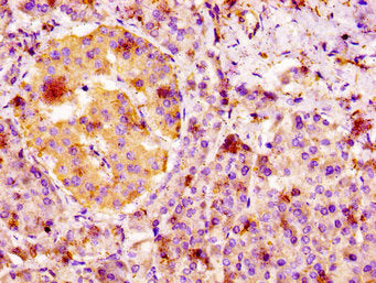 IHC image of CSB-PA008648LA01HU diluted at 1:100 and staining in paraffin-embedded human pancreatic tissue performed on a Leica BondTM system. After dewaxing and hydration, antigen retrieval was mediated by high pressure in a citrate buffer (pH 6....