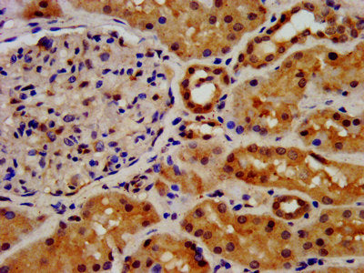 IHC image of CSB-PA008650LA01HU diluted at 1:500 and staining in paraffin-embedded human kidney tissue performed on a Leica BondTM system. After dewaxing and hydration, antigen retrieval was mediated by high pressure in a citrate buffer (pH 6.0)....
