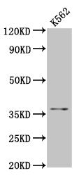 Western Blot Positive WB detected in: K562 whole cell lysate All lanes: FGL1 antibody at 5.8µg/ml Secondary Goat polyclonal to rabbit IgG at 1/50000 dilution Predicted band size: 37 kDa Observed band size: 37 kDa