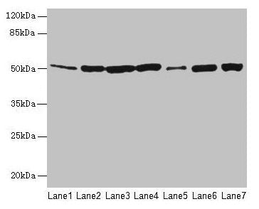 Western blot All lanes: FH antibody at 12µg/ml Lane 1: Mouse heart tissue Lane 2: Mouse liver tissue Lane 3: Mouse kidney tissue Lane 4: Mouse brain tissue Lane 5: Human placenta tissue Lane 6: Hela whole cell lysate Lane 7: HepG2 whole cell lysat...