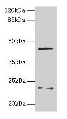 Western blot All lanes: FIBP antibody at 6µg/ml + MCF-7 whole cell lysate Secondary Goat polyclonal to rabbit IgG at 1/10000 dilution Predicted band size: 42 kDa Observed band size: 42 kDa