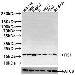 Western Blot Positive WB detected in: HEK293 whole cell lysate(20µg), Hela whole cell lysate(20µg), HepG2 whole cell lysate(20µg), JK whole cell lysate(20µg), MCF7 whole cell lysate(20µg), K562 whole cell lysate(20µg),SH-SY5Y whole cell lysate(20µ...