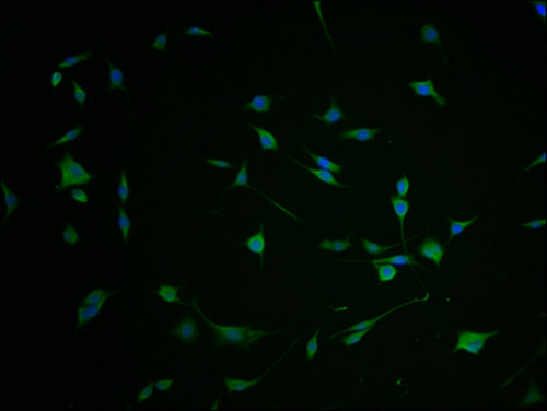 Immunofluorescence staining of SH-SY5Y cells with CSB-PA008692LA01HU-IF at 1:100, counter-stained with DAPI. The cells were fixed in 4% formaldehyde and blocked in 10% normal Goat Serum. The cells were then incubated with the antibody overnight at...