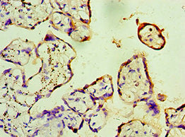 Immunohistochemistry of paraffin-embedded human placenta tissue using CSB-PA008698ESR1HU at dilution of 1:100