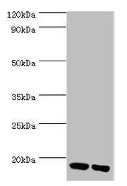 Western blot All lanes: Peptidyl-prolyl cis-trans isomerase FKBP2 antibody at 10ug/ml Lane 1: Mouse thymus tissue Lane 2: Rat brain tissue Secondary Goat polyclonal to rabbit IgG at 1/10000 dilution Predicted band size: 16 kDa Observed band size:...