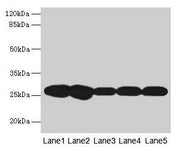 Western blot All lanes: FKBP3 antibody at 4µg/ml Lane 1: Hela whole cell lysate Lane 2: A431 whole cell lysate Lane 3: PC-3 whole cell lysate Lane 4: Jurkat whole cell lysate Lane 5: 293T whole cell lysate Secondary Goat polyclonal to rabbit IgG a...