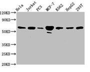 Western Blot Positive WB detected in: Hela whole cell lysate, Jurkat whole cell lysate, PC-3 whole cell lysate, MCF-7 whole cell lysate, K562 whole cell lysate, HepG2 whole cell lysate, 293T whole cell lysate All lanes: FKBP4 antibody at 3.3µg/ml...