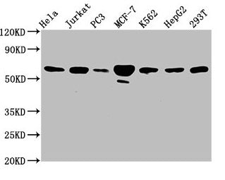 Western Blot Positive WB detected in: Hela whole cell lysate, Jurkat whole cell lysate, PC-3 whole cell lysate, MCF-7 whole cell lysate, K562 whole cell lysate, HepG2 whole cell lysate, 293T whole cell lysate All lanes: FKBP4 antibody at 3.3µg/ml...