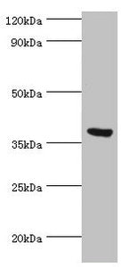 Western blot All lanes: Peptidyl-prolyl cis-trans isomerase FKBP4 antibody at 0.5ug/ml + MCF-7 whole cell lysate Secondary Goat polyclonal to rabbit IgG at 1/10000 dilution Predicted band size: 52 kDa Observed band size: 52 kDa