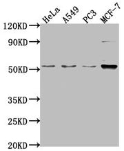 Western Blot Positive WB detected in: Hela whole cell lysate, A549 whole cell lysate, PC-3 whole cell lysate, MCF-7 whole cell lysate All lanes: FKTN antibody at 1:2000 Secondary Goat polyclonal to rabbit IgG at 1/50000 dilution Predicted band siz...
