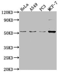 Western Blot Positive WB detected in: Hela whole cell lysate, A549 whole cell lysate, PC-3 whole cell lysate, MCF-7 whole cell lysate All lanes: FKTN antibody at 1:2000 Secondary Goat polyclonal to rabbit IgG at 1/50000 dilution Predicted band siz...