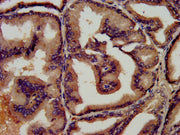 IHC image of CSB-PA00870E0Rb diluted at 1:450 and staining in paraffin-embedded human prostate tissue performed on a Leica BondTM system. After dewaxing and hydration, antigen retrieval was mediated by high pressure in a citrate buffer (pH 6.0). S...