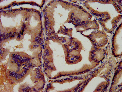 IHC image of CSB-PA00870E0Rb diluted at 1:450 and staining in paraffin-embedded human prostate tissue performed on a Leica BondTM system. After dewaxing and hydration, antigen retrieval was mediated by high pressure in a citrate buffer (pH 6.0). S...