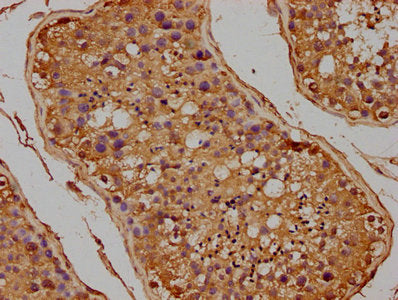 IHC image of CSB-PA008711HA01HU diluted at 1:100 and staining in paraffin-embedded human testis tissue performed on a Leica BondTM system. After dewaxing and hydration, antigen retrieval was mediated by high pressure in a citrate buffer (pH 6.0)....