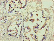 Immunohistochemistry of paraffin-embedded human prostate tissue using CSB-PA008712HA01HU at dilution of 1:100