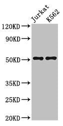 Western Blot Positive WB detected in: Jurkat whole cell lysate, K562 whole cell lysate All lanes: FLI1 antibody at 3µg/ml Secondary Goat polyclonal to rabbit IgG at 1/50000 dilution Predicted band size: 51, 44, 48, 30 kDa Observed band size: 51 kDa