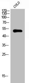 Western Blot analysis of COLO cells using GATA-4 Polyclonal Antibody