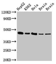 Western Blot Positive WB detected in: HepG2 whole cell lysate, K562 whole cell lysate, Hela whole cell lysate, Rat brain tissue, Mouse brain tissue All lanes: FLOT1 antibody at 3µg/ml Secondary Goat polyclonal to rabbit IgG at 1/50000 dilution Pre...