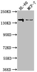Western Blot Positive WB detected in: HL-60 whole cell lysate, MCF-7 whole cell lysate All lanes: FLT3 antibody at 1:2000 Secondary Goat polyclonal to rabbit IgG at 1/50000 dilution Predicted band size: 113, 109 kDa Observed band size: 140 kDa