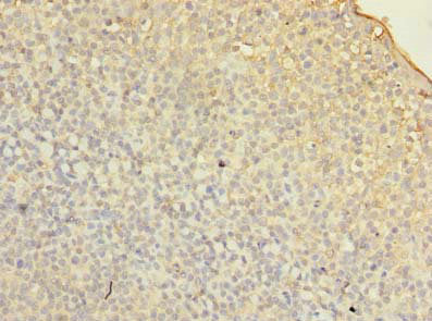 Immunohistochemistry of paraffin-embedded human tonsil tissue using CSB-PA008743LA01HU at dilution of 1:100