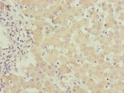 Immunohistochemistry of paraffin-embedded human liver tissue using CSB-PA008750LA01HU at dilution of 1:100